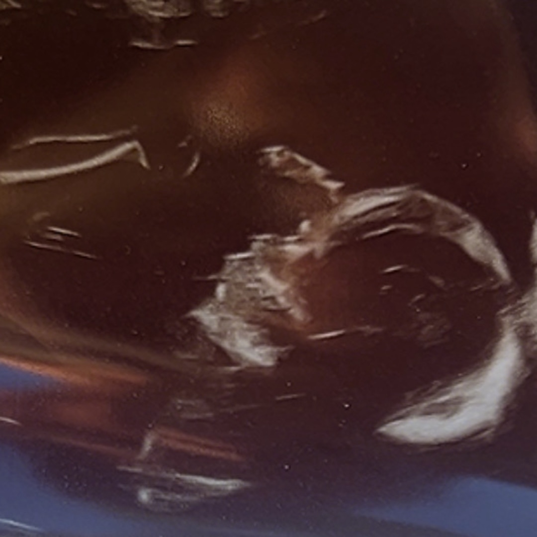 Photo shared by Natalie for their Babylist baby registry.