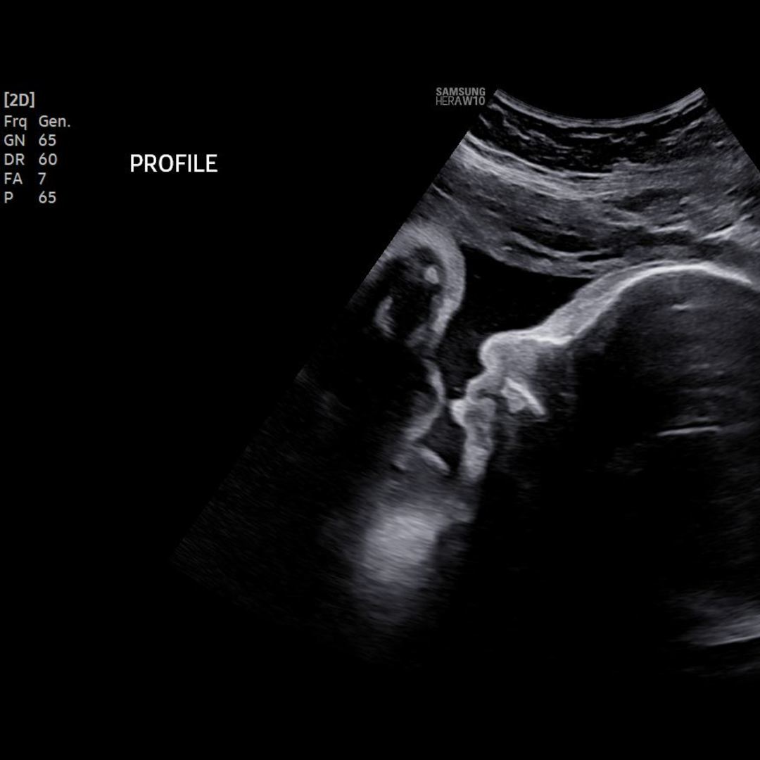 Photo shared by Ilana for their Babylist baby registry.