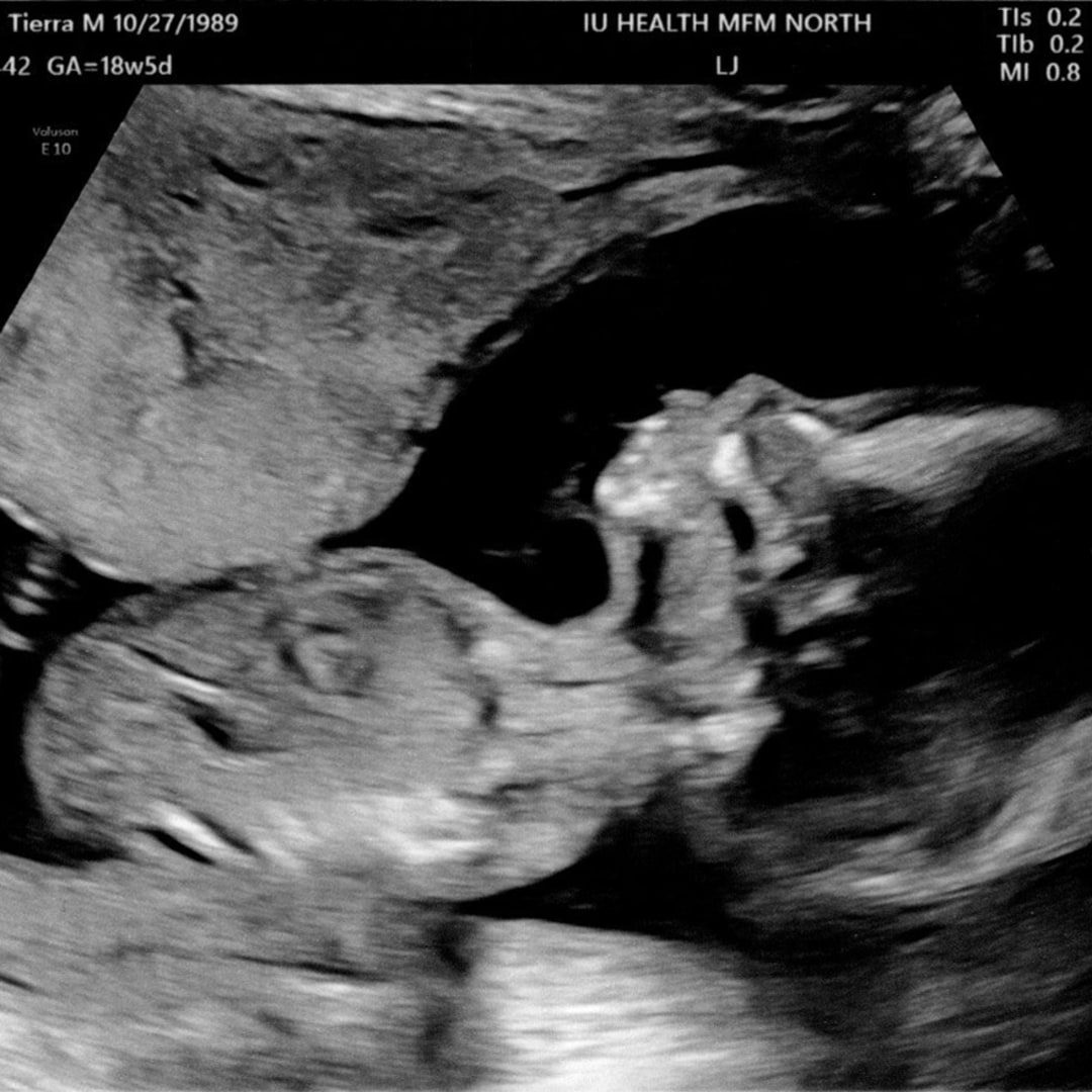 Photo shared by Khaim for their Babylist baby registry.