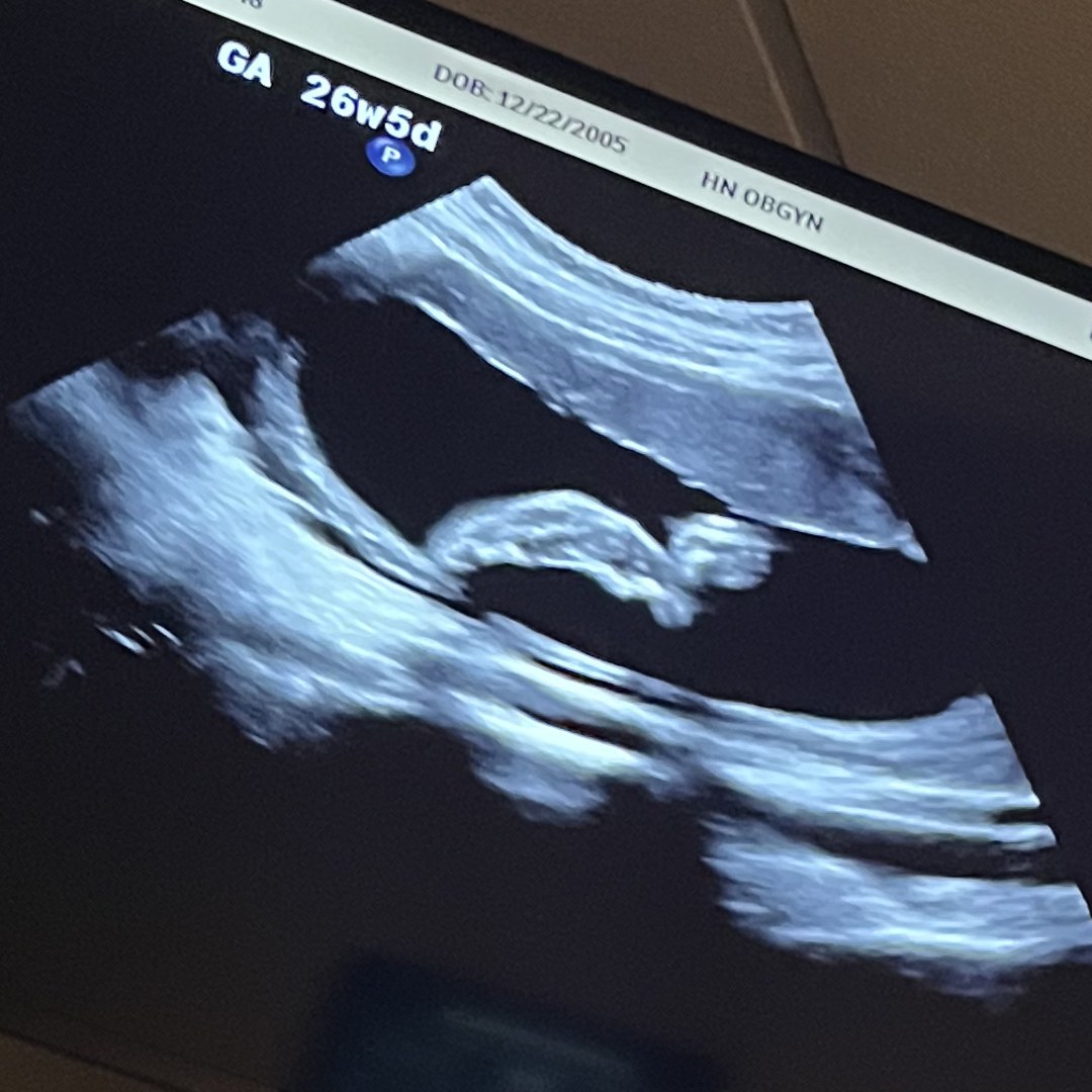 Photo shared by Whitney for their Babylist baby registry.