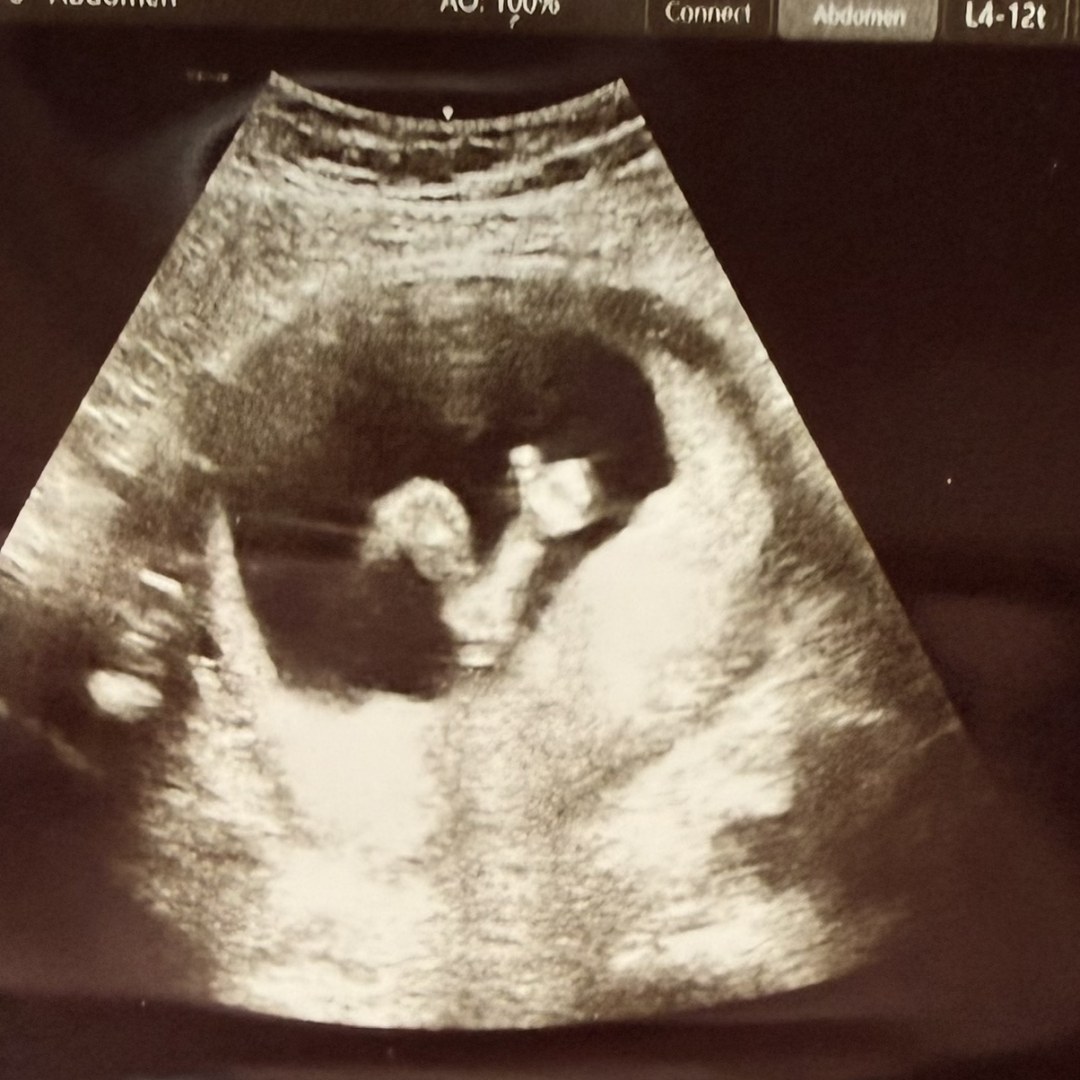 Photo shared by Morgan for their Babylist baby registry.