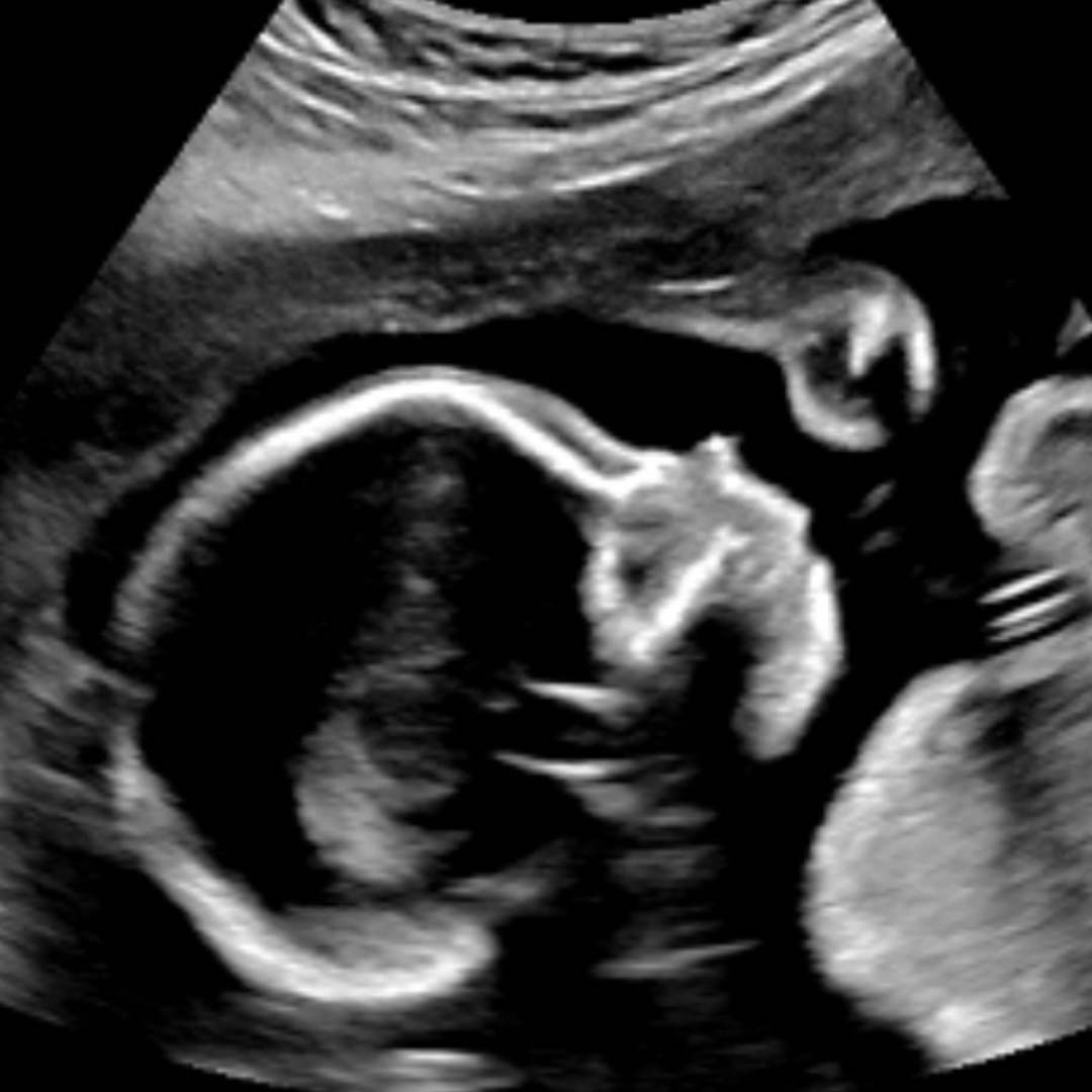 Photo shared by Caitlin for their Babylist baby registry.