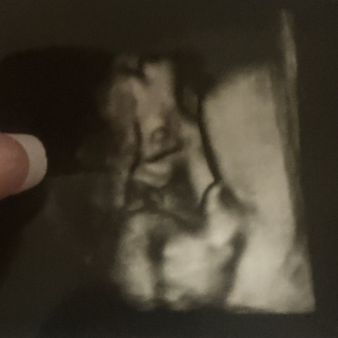 Photo shared by Aliah for their Babylist baby registry.
