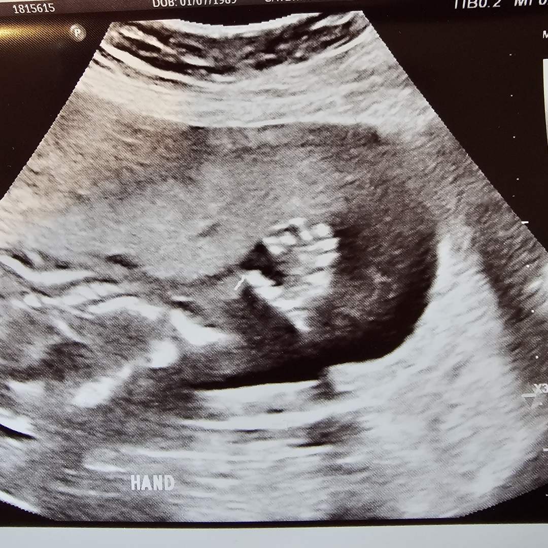 Photo shared by Ashley for their Babylist baby registry.
