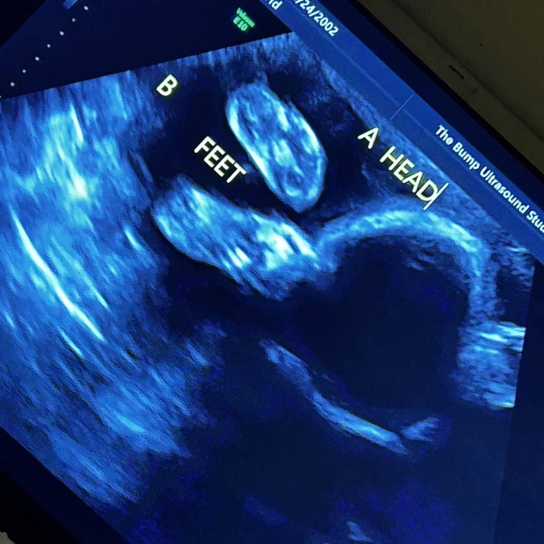 Photo shared by Lileigh for their Babylist baby registry.