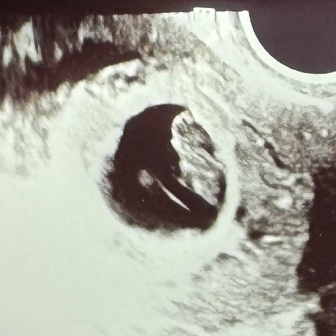 Photo shared by Ashley for their Babylist baby registry.