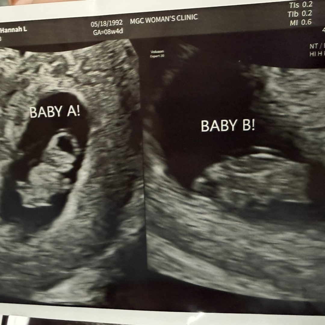 Photo shared by Hannah for their Babylist baby registry.