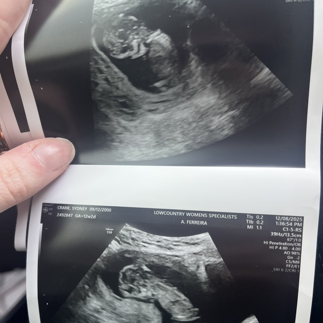 Photo shared by Sydney for their Babylist baby registry.