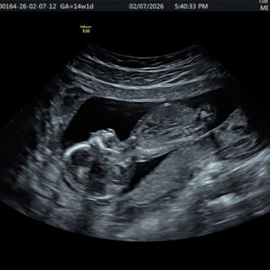 Photo shared by Kiany for their Babylist baby registry.