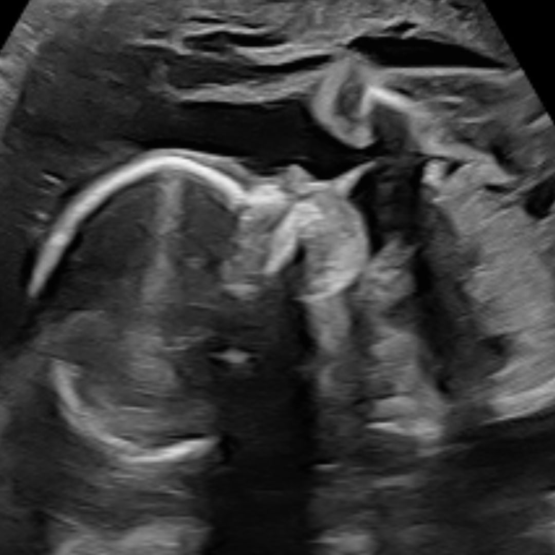 Photo shared by Laura for their Babylist baby registry.