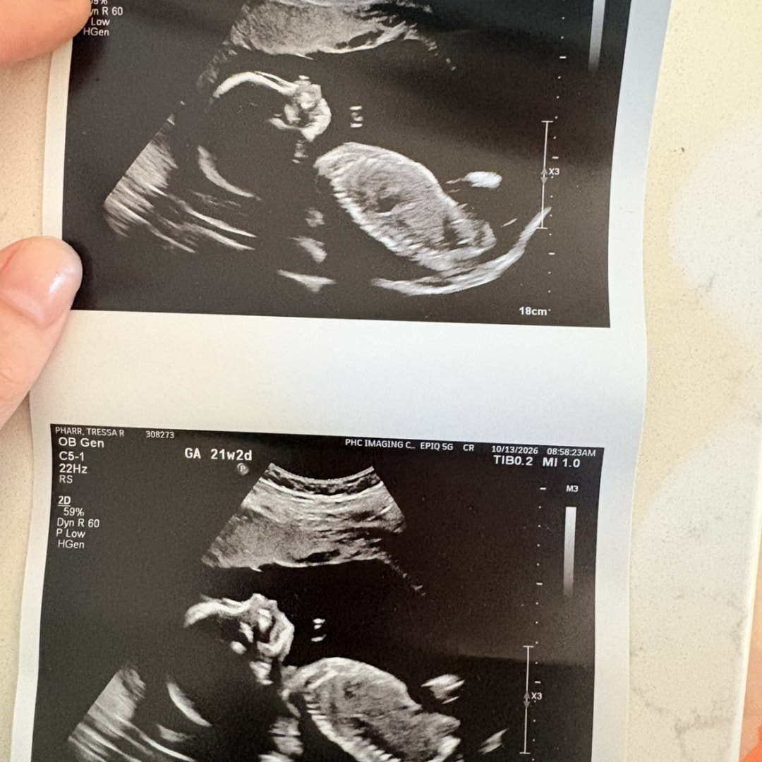 Photo shared by Tressa for their Babylist baby registry.