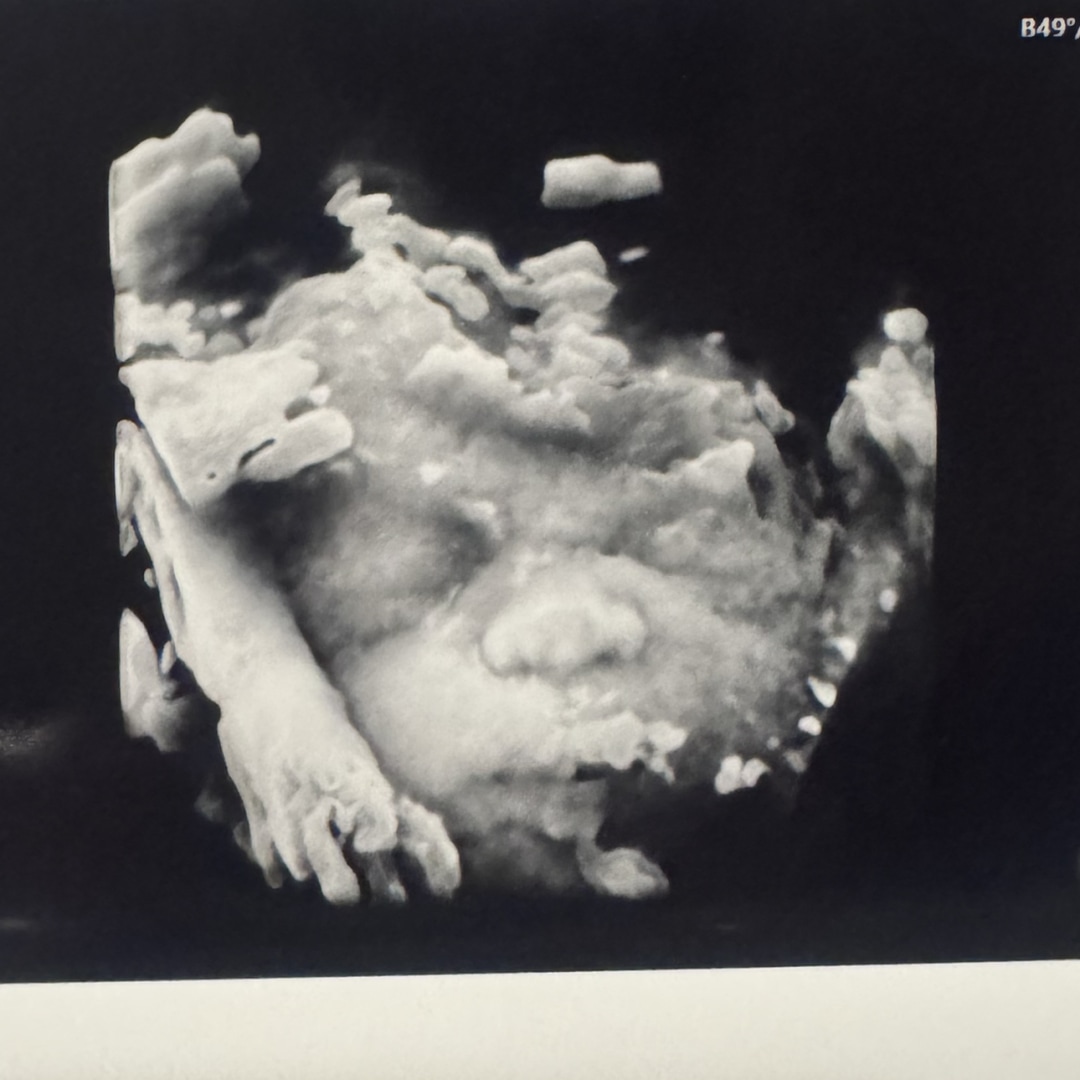 Photo shared by Ajina for their Babylist baby registry.
