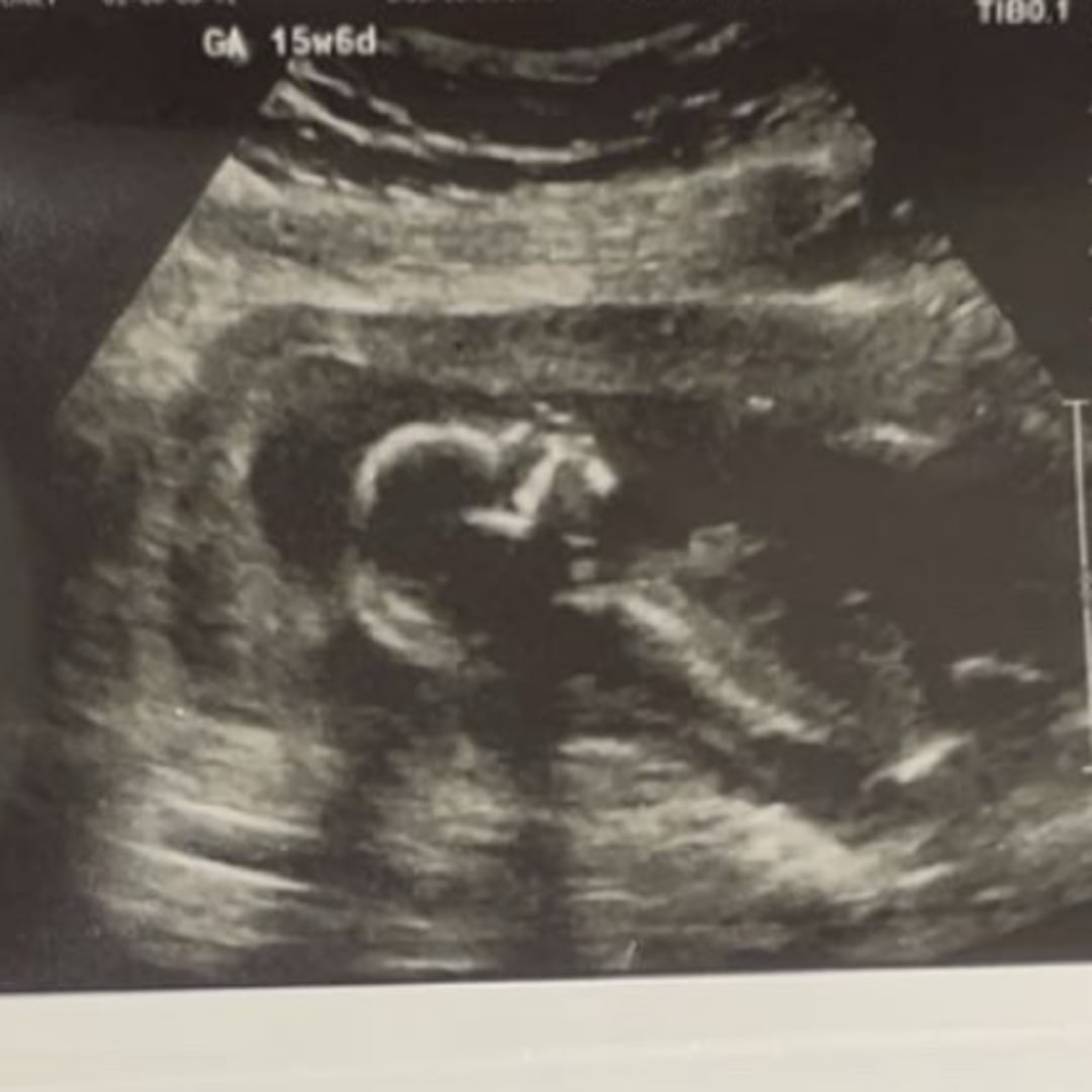 Photo shared by Sydney for their Babylist baby registry.