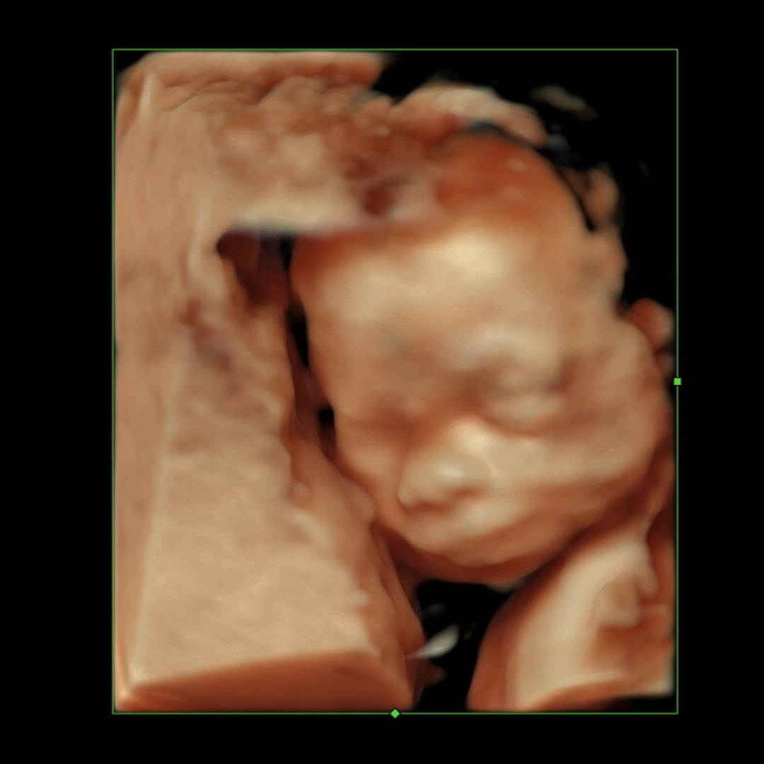 Photo shared by Reilly for their Babylist baby registry.
