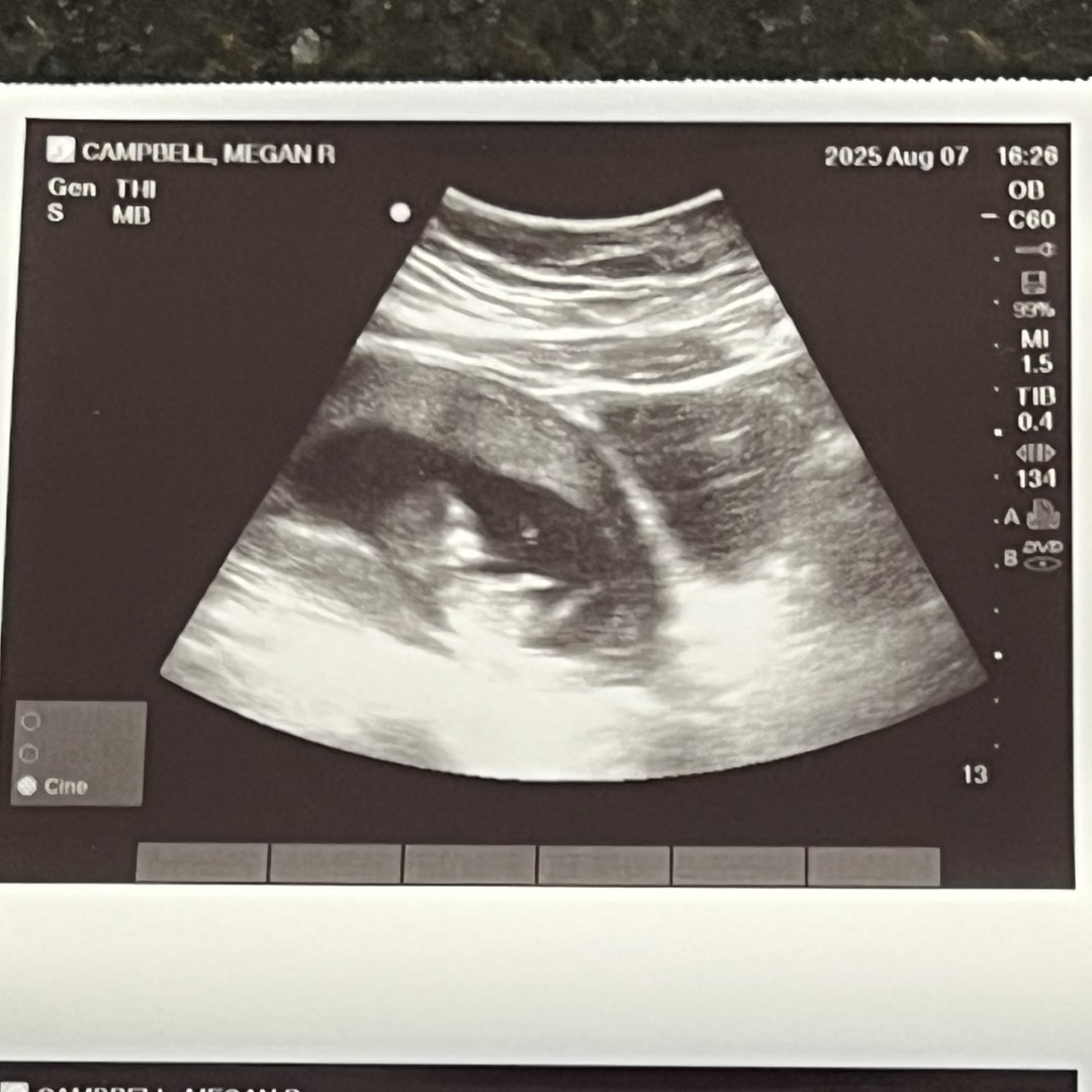 Photo shared by Megan for their Babylist baby registry.