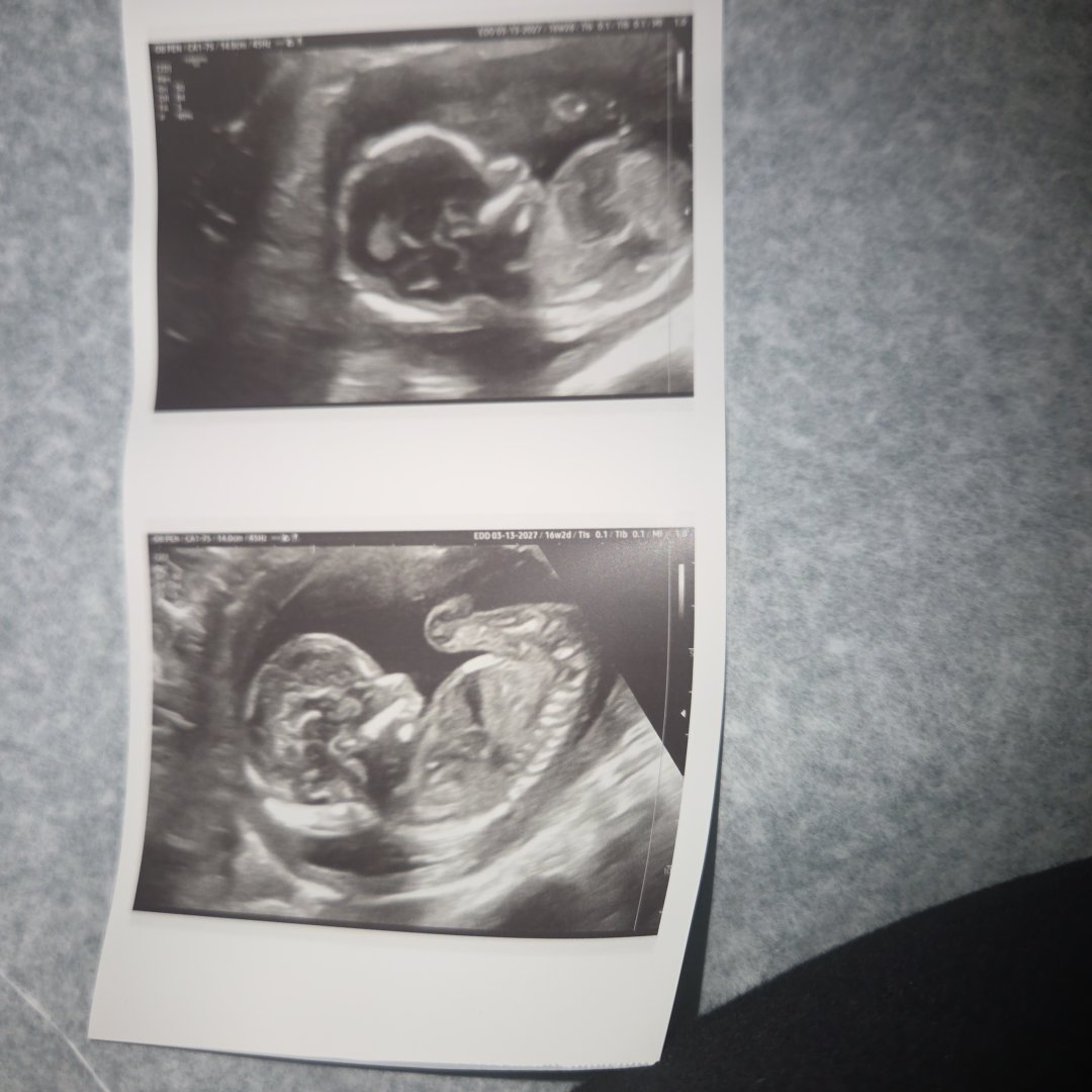 Photo shared by Liz for their Babylist baby registry.