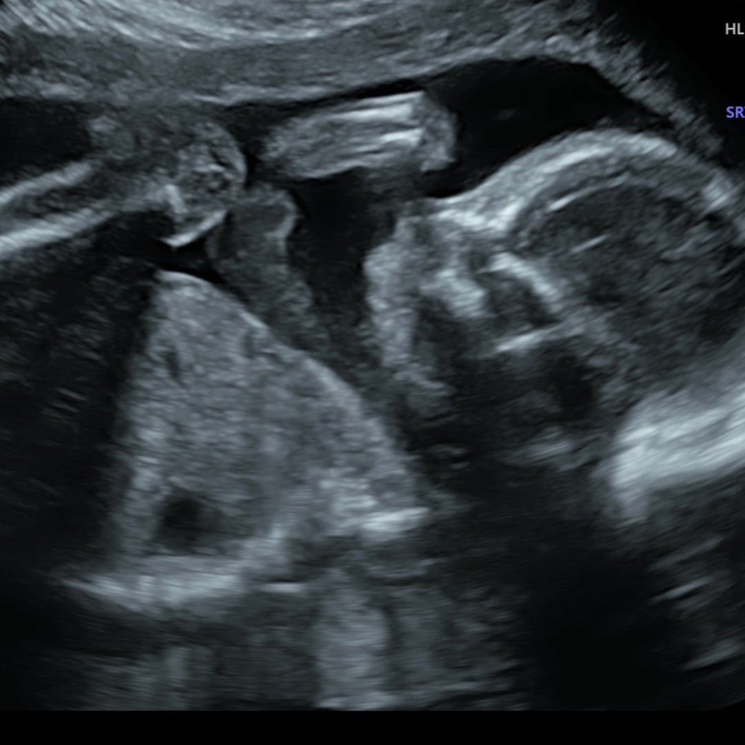 Photo shared by Angelle for their Babylist baby registry.