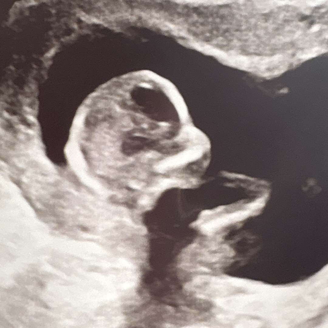 Photo shared by Jayda for their Babylist baby registry.