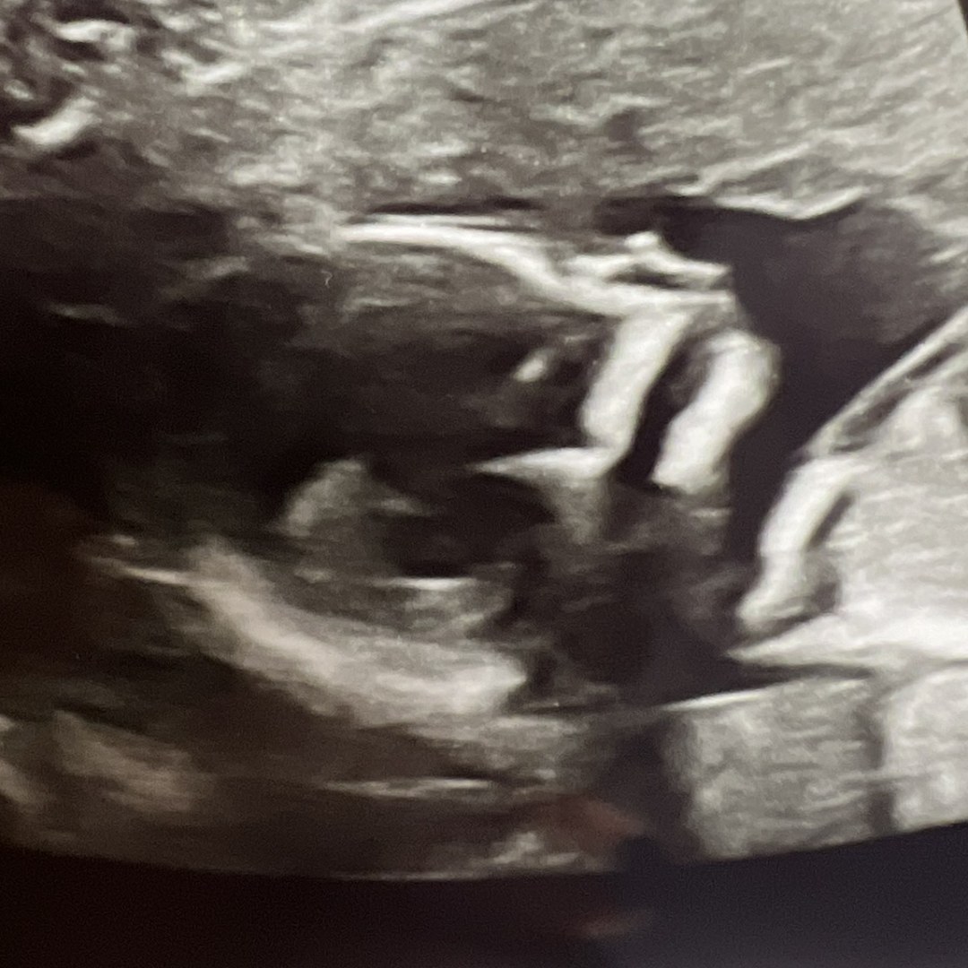 Photo shared by Claire for their Babylist baby registry.