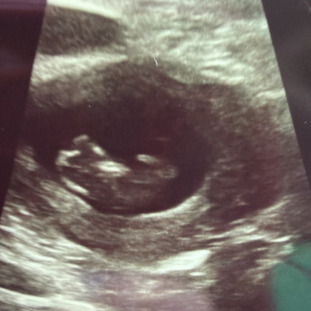Photo shared by Megan for their Babylist baby registry.