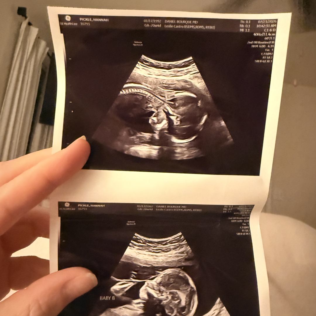 Photo shared by Hannah for their Babylist baby registry.