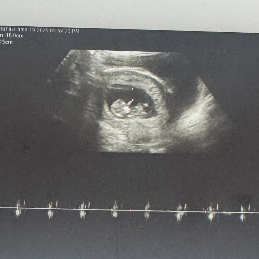 Photo shared by Koreena for their Babylist baby registry.