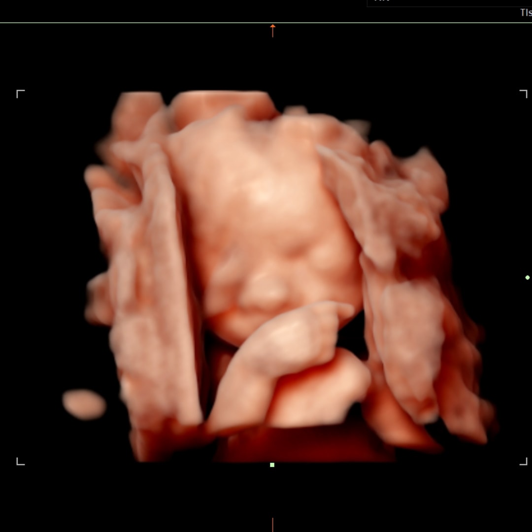 Photo shared by Melissa for their Babylist baby registry.