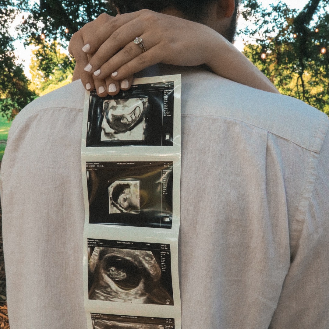 Photo shared by Katelyn for their Babylist baby registry.