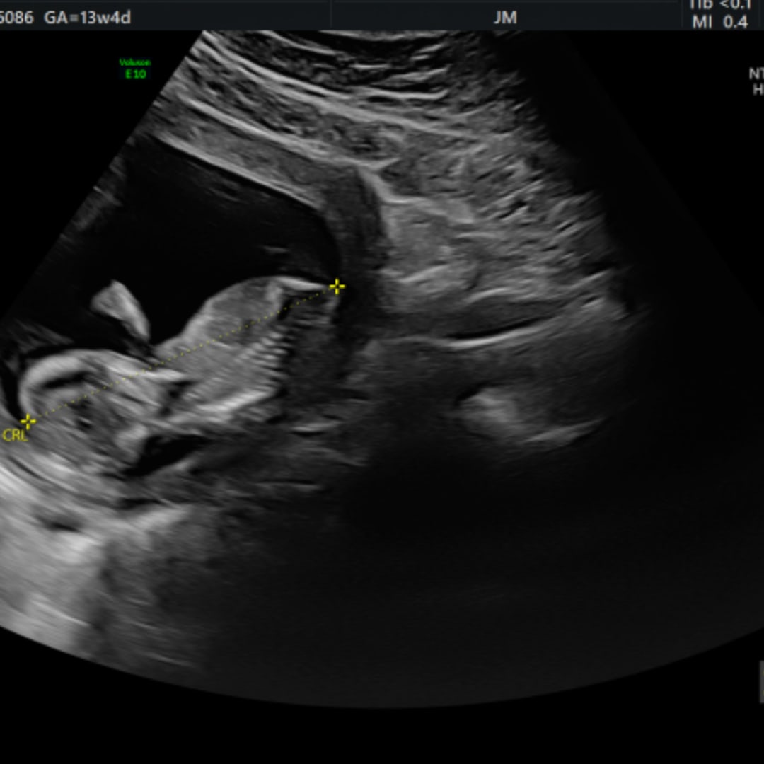 Photo shared by Allison for their Babylist baby registry.