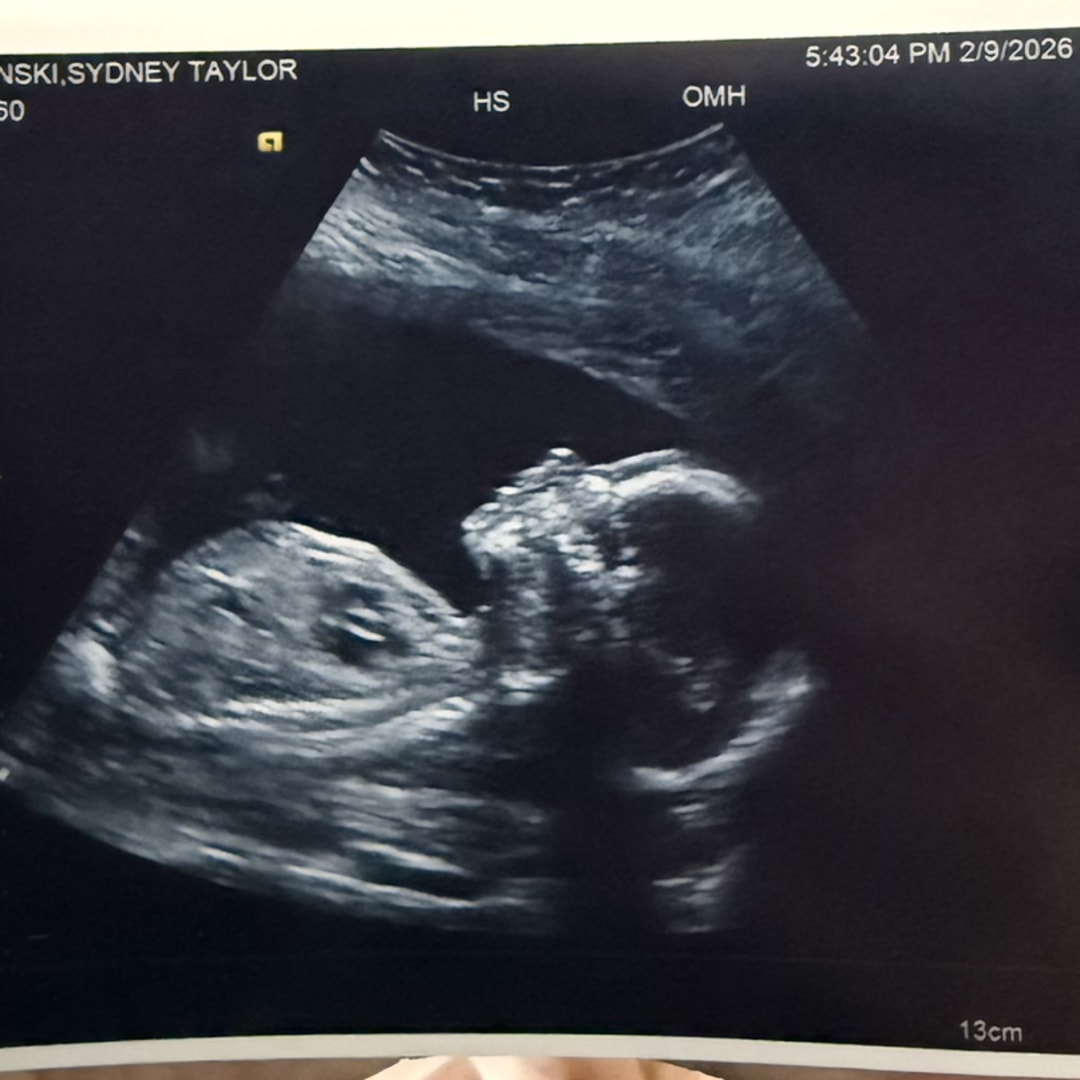 Photo shared by Sydney for their Babylist baby registry.
