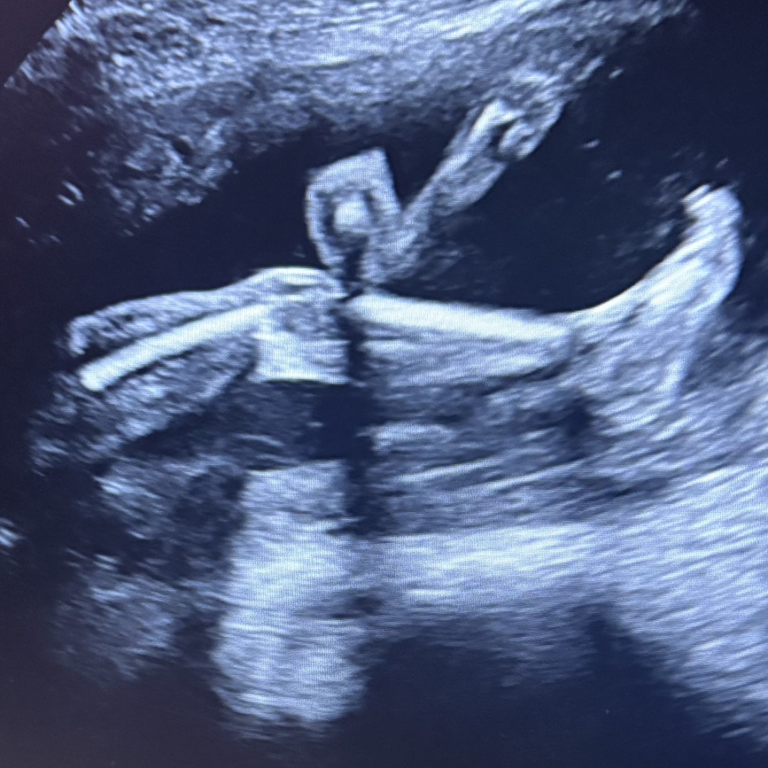 Photo shared by Brooke for their Babylist baby registry.