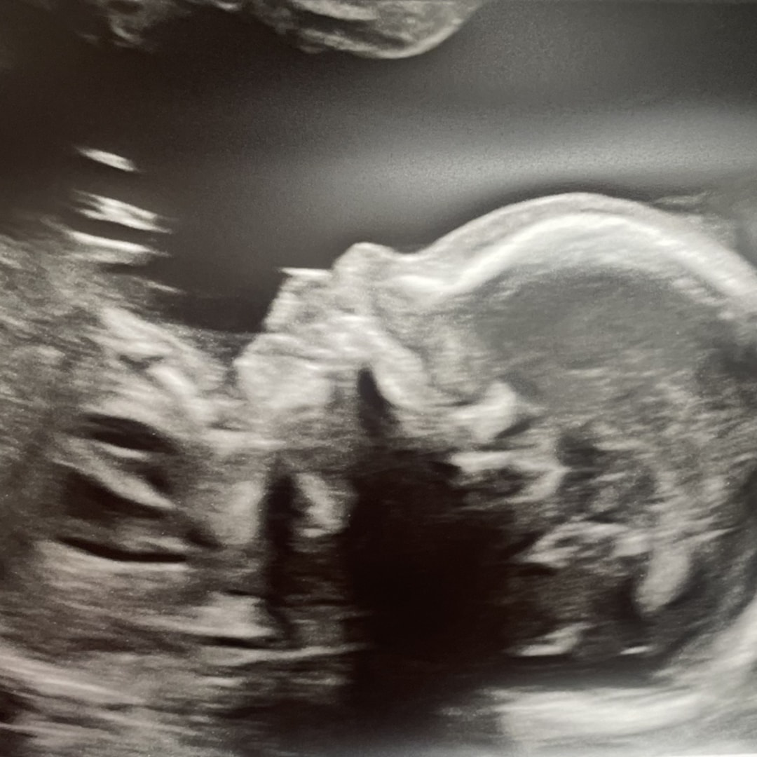Photo shared by Gabrielle for their Babylist baby registry.