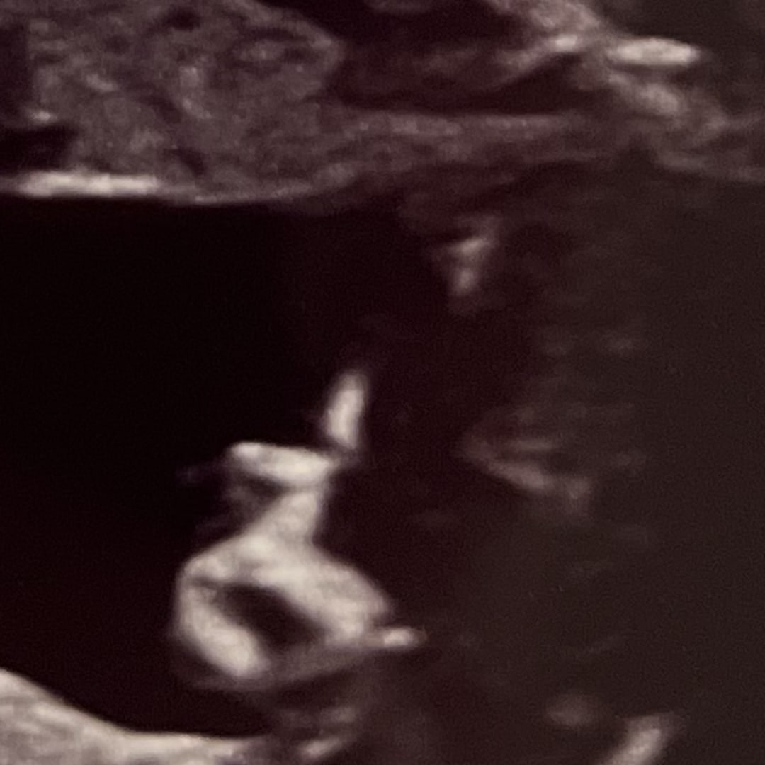 Photo shared by Yineilia for their Babylist baby registry.