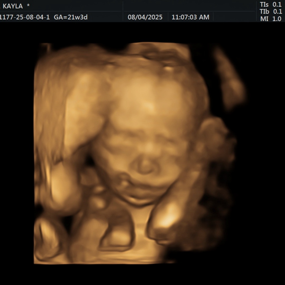 Photo shared by Kayla for their Babylist baby registry.