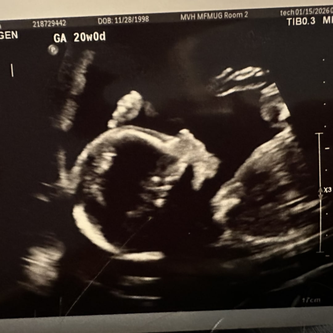 Photo shared by Victoria for their Babylist baby registry.