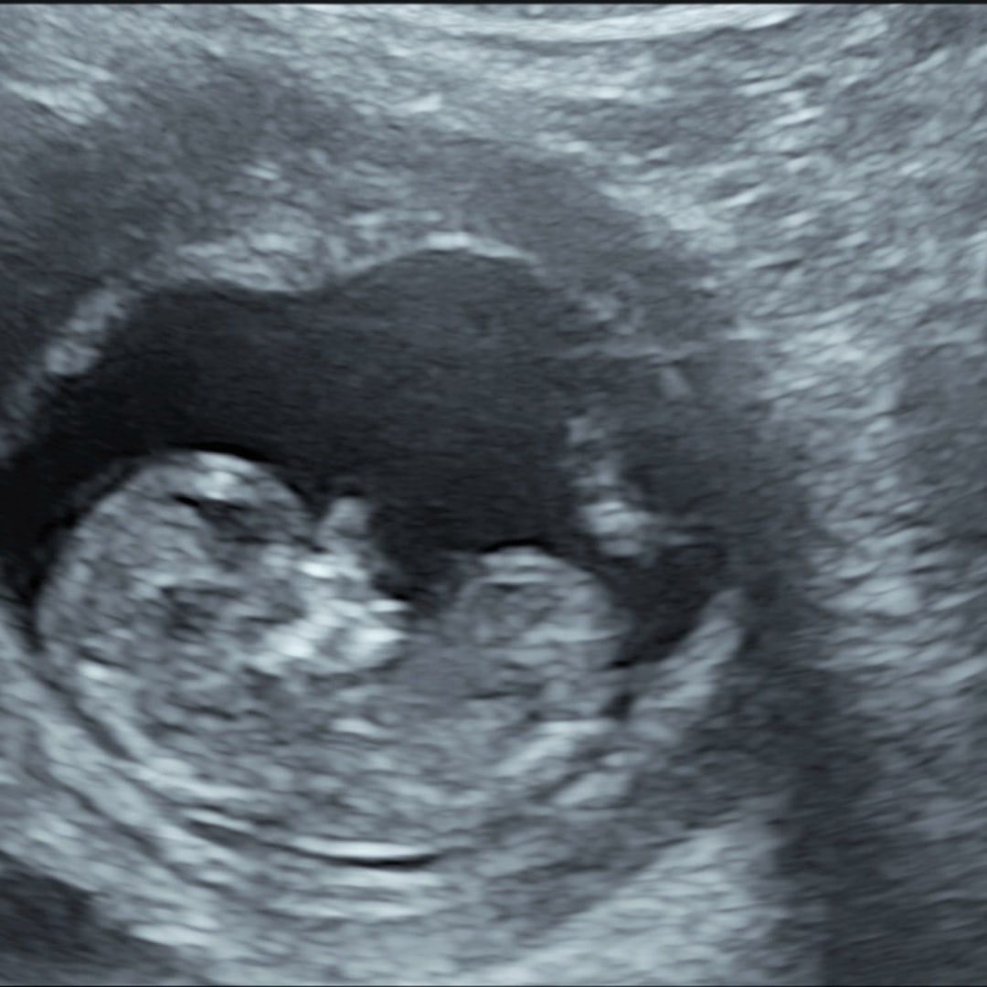 Photo shared by Jacey for their Babylist baby registry.