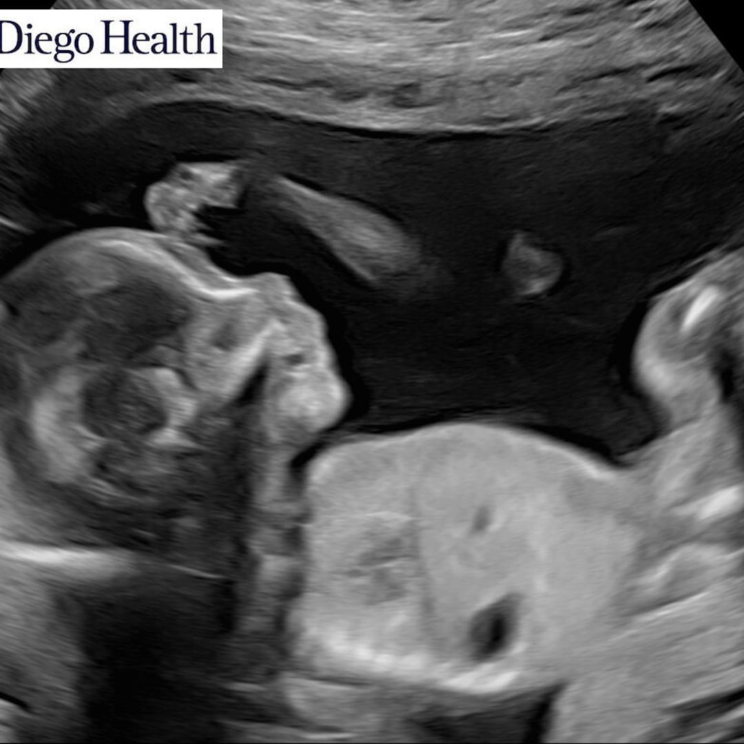 Photo shared by Celina for their Babylist baby registry.