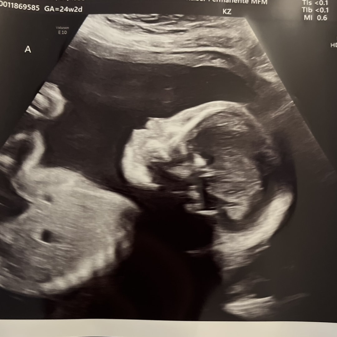 Photo shared by Karol for their Babylist baby registry.