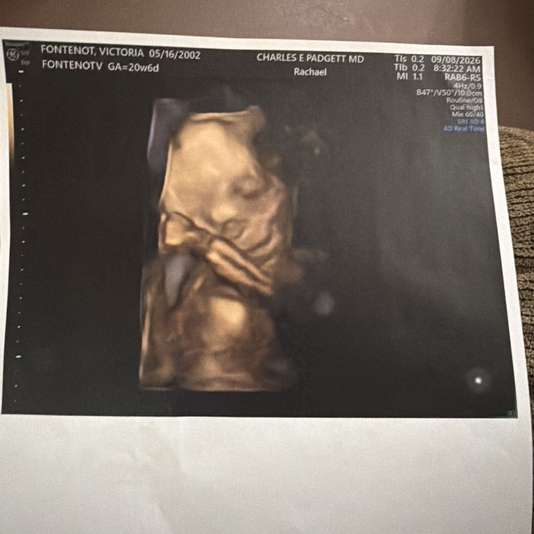 Photo shared by Victoria for their Babylist baby registry.