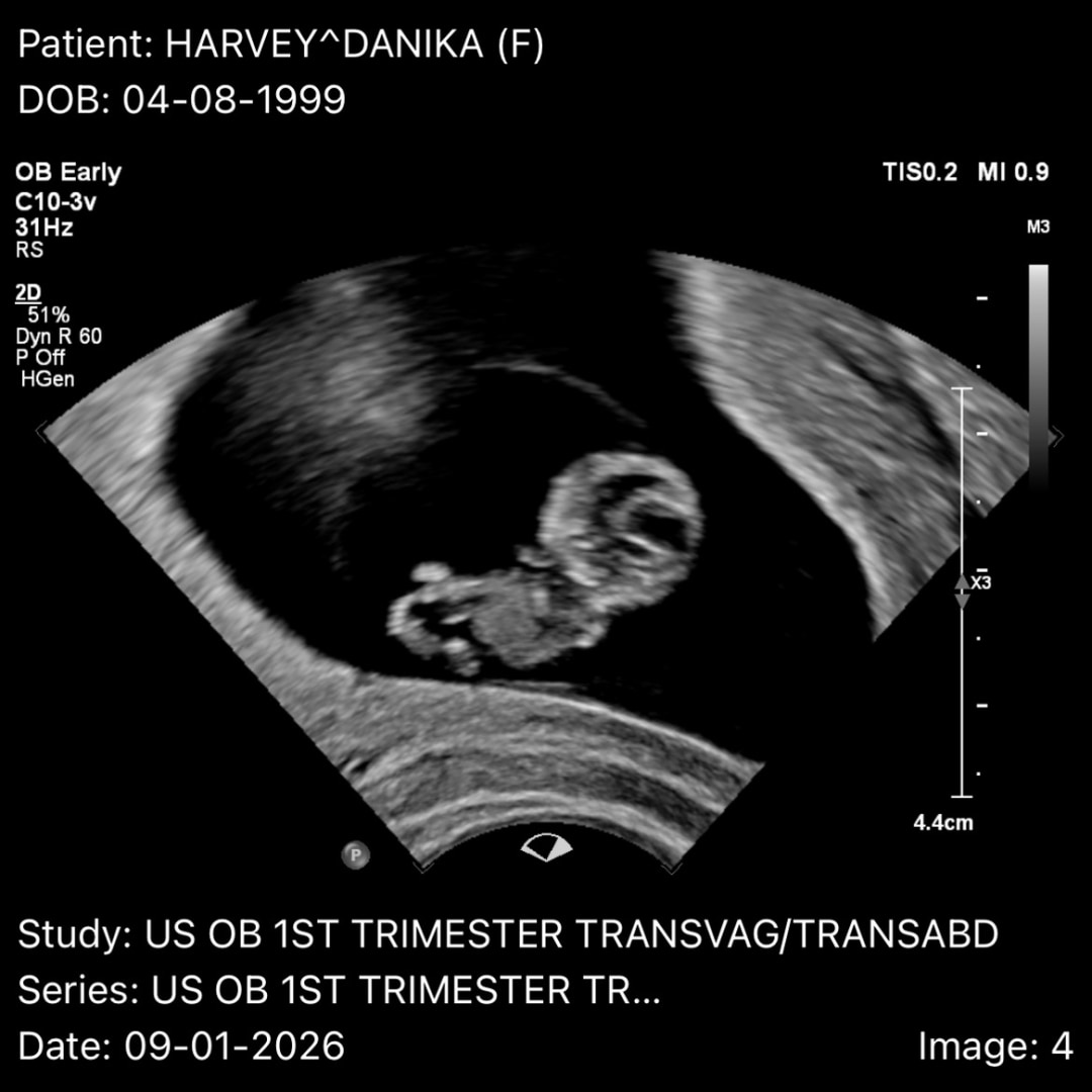 Photo shared by Danika for their Babylist baby registry.