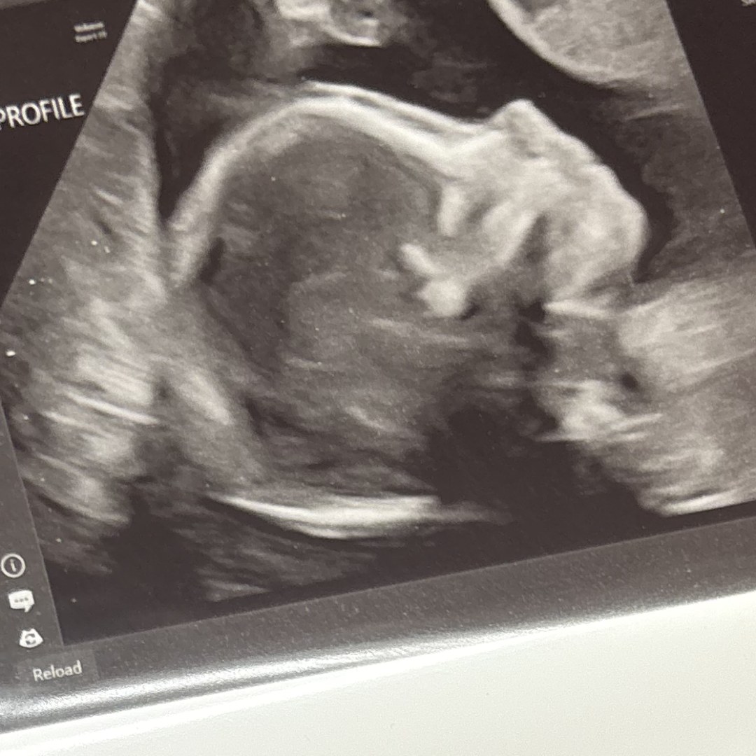Photo shared by Anneliese for their Babylist baby registry.