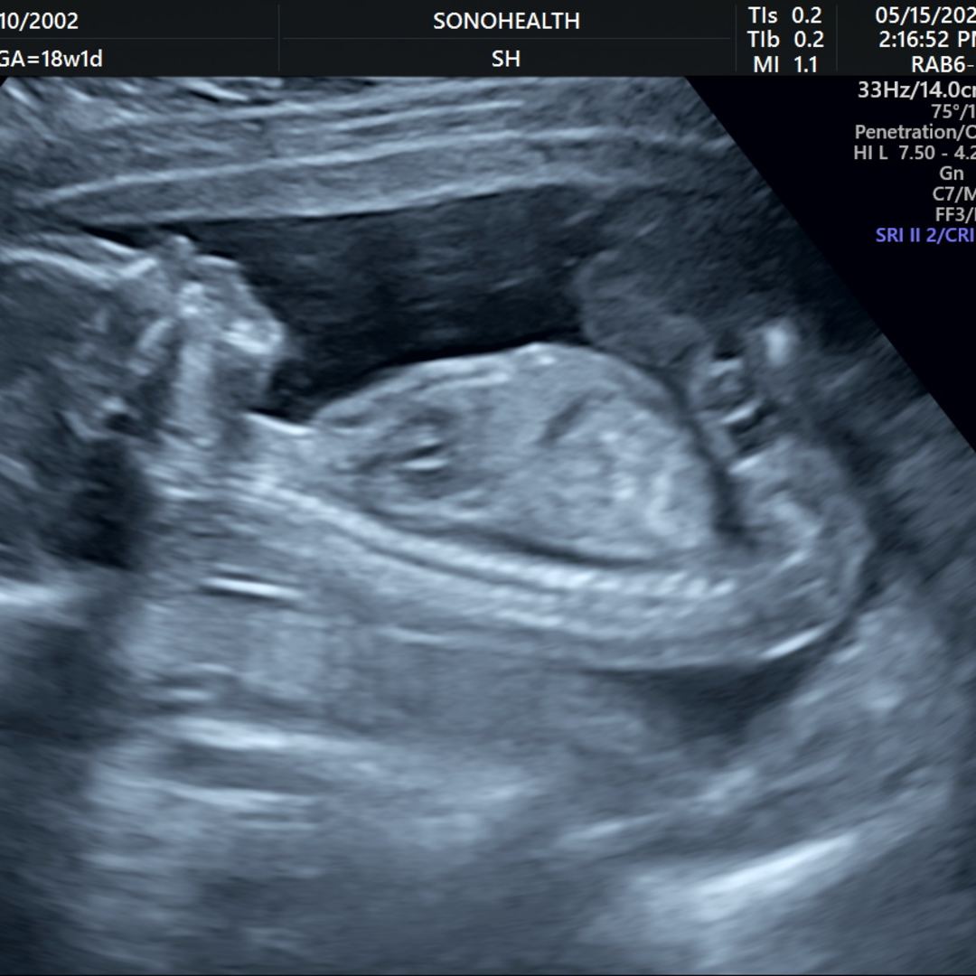 Photo shared by Pauline for their Babylist baby registry.