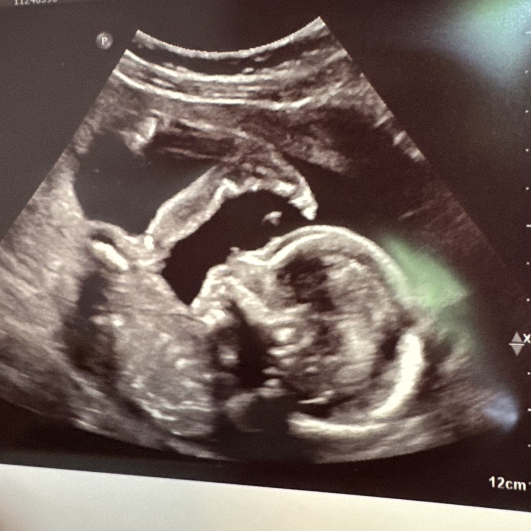 Photo shared by Amber Lynn for their Babylist baby registry.