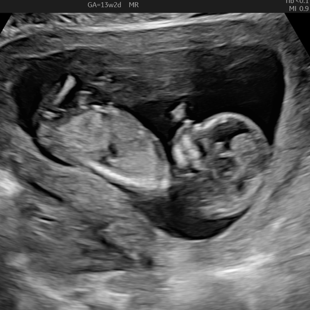 Photo shared by Abigail for their Babylist baby registry.