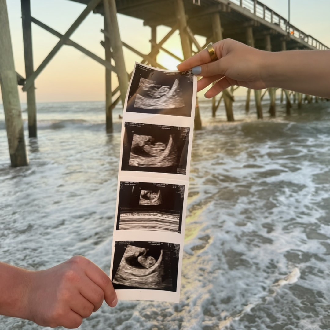 Photo shared by Alyssa for their Babylist baby registry.