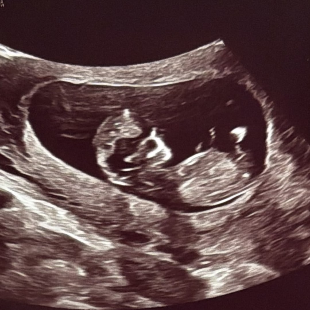 Photo shared by Brittany for their Babylist baby registry.
