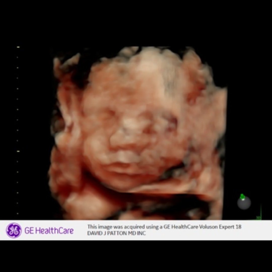 Photo shared by Mariah for their Babylist baby registry.