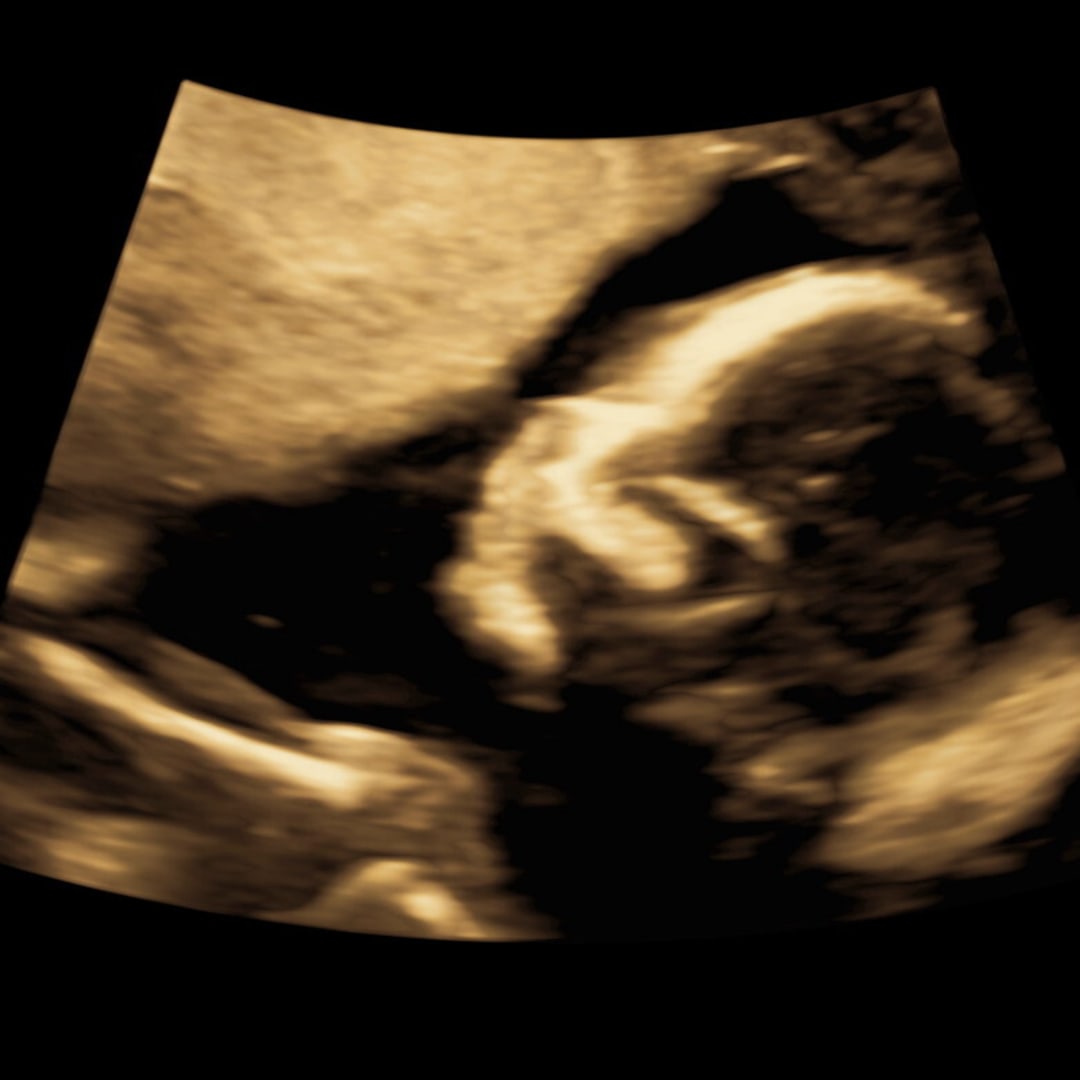 Photo shared by Shelby for their Babylist baby registry.