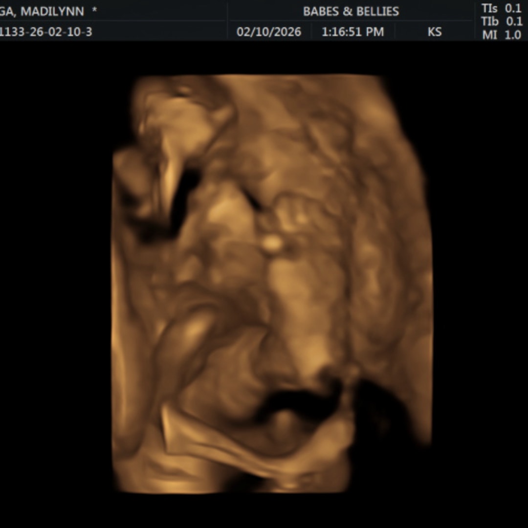 Photo shared by Madilynn & Jerry for their Babylist baby registry.