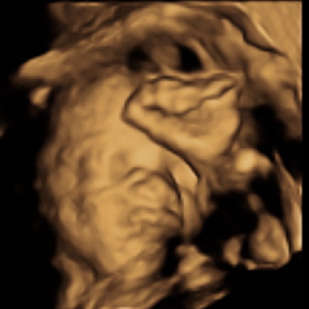 Photo shared by Emily for their Babylist baby registry.